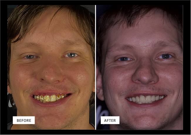 Smile Gallery | Woodlands Family Dental
